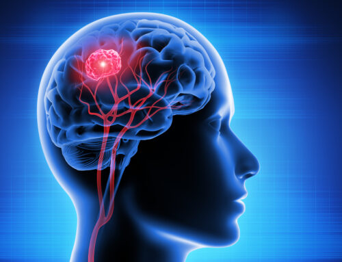 Brain Tumor – Symptoms, Causes & Treatment
