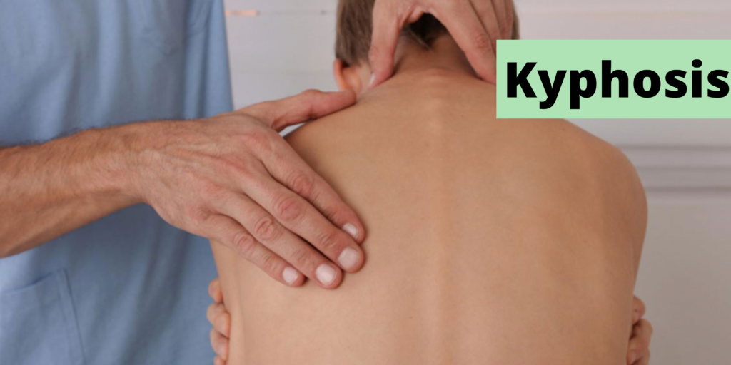 Kyphosis Symptoms Causes And Treatment Arihant Neuro 7650