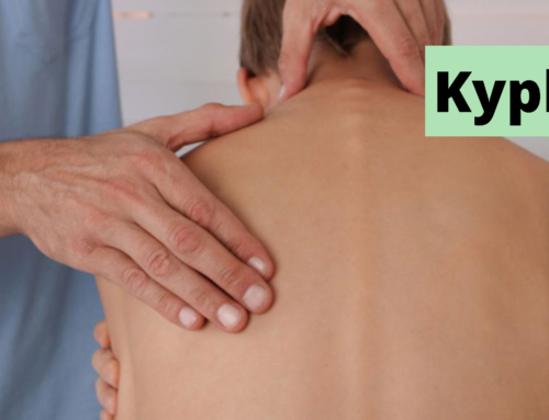 Kyphosis – Symptoms , Causes and Treatment